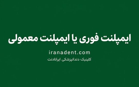 ایمپلنت فوری بهتر است یا ایمپلنت معمولی؟ مقایسه شرایط، زمان و نتیجه درمان